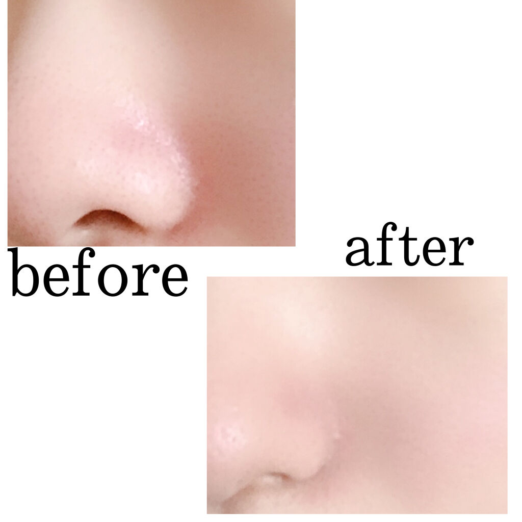 スキンイリュージョンプライマーuv コフレドールの口コミ コフレドールの化粧下地のサンプルを頂いたの By まかろなっち 敏感肌 10代後半 Lips