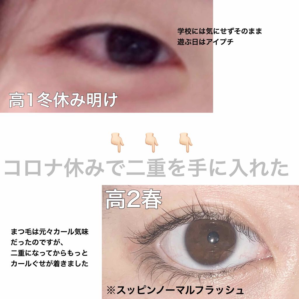 のび る アイテープ 絆創膏タイプ Daisoの画像 動画一覧 22ページ目 Lips