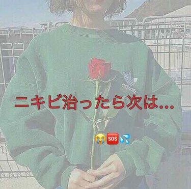 明色 美顔水 薬用化粧水 明色化粧品を使った口コミ ニキビ治りました やったー って思っ By ちょこ 敏感肌 10代前半 Lips