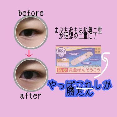 救急ばんそうこう ドン キホーテの使い方を徹底解説 こんにちは さいとう です 今回は 前 By さいとう Lips