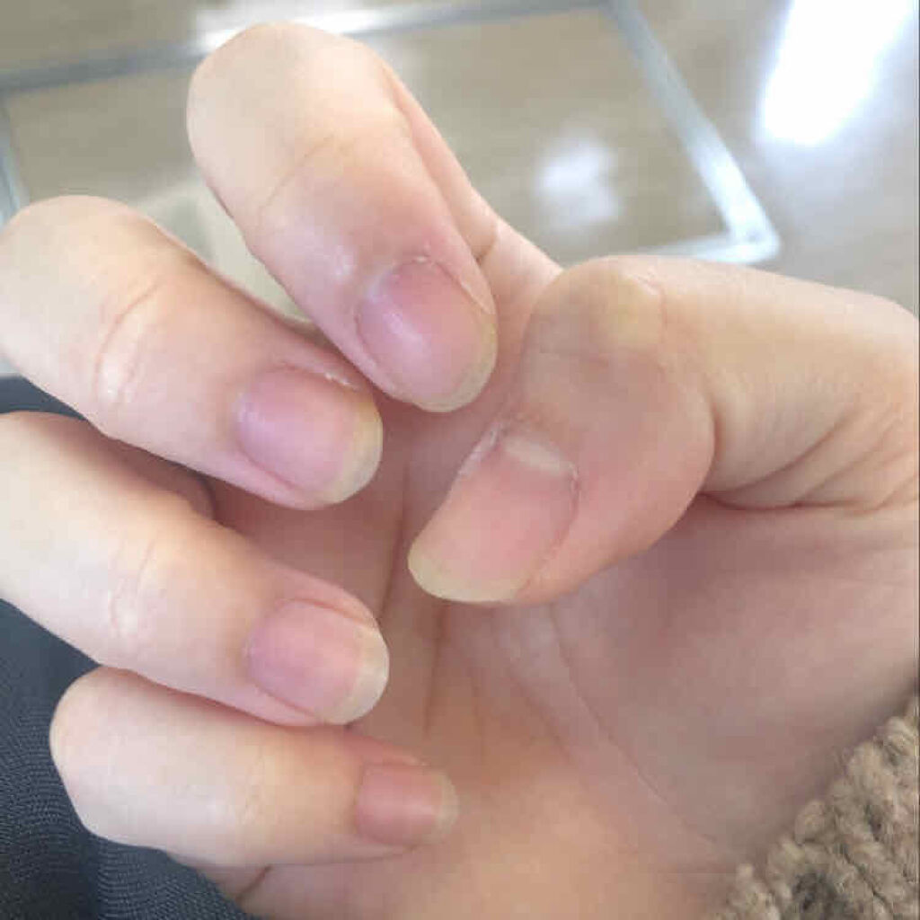 キューティクルネイルオイル ペンタイプ No Nail No Lifeを使った口コミ 育爪 これなんて読むんでしょうね 育乳とか By しに子ちゃん 乾燥肌 Lips