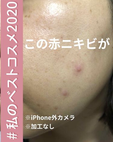 1000円以下 セラミド美容液 ビーエスコスメのリアルな口コミ レビュー Lips