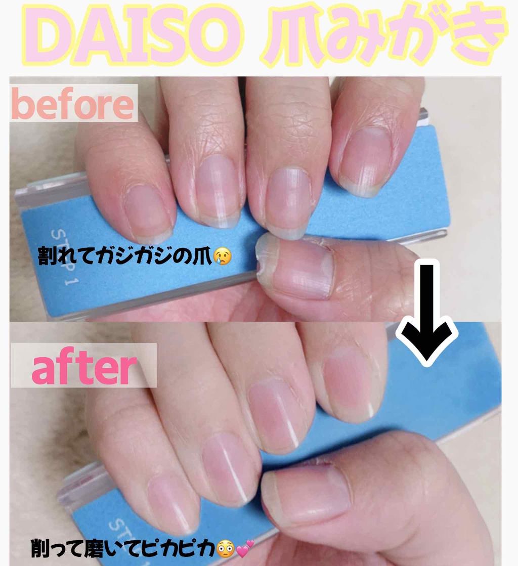 3ステップつめみがき Daisoの口コミ 超優秀 100均で買えるおすすめネイル用品 Daiso3ステップ By ୨୧ 𝕡𝕪𝕠𝕟 ୨୧ 乾燥肌 Lips
