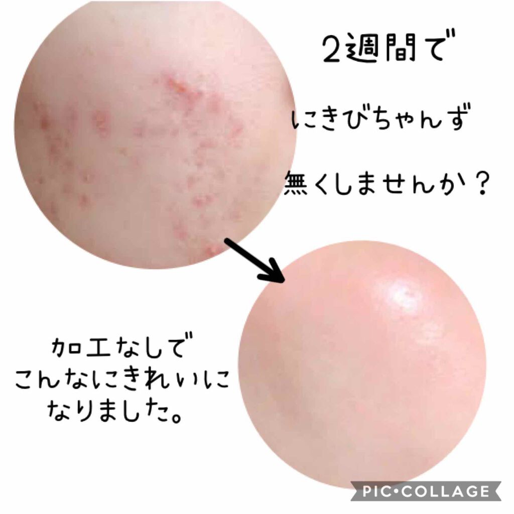 スキンケア方法 薬用 しみ 集中対策 美容液 メンソレータム メラノccの使い方 効果 こんにちは 不定期投稿 By ひな 混合肌 Lips