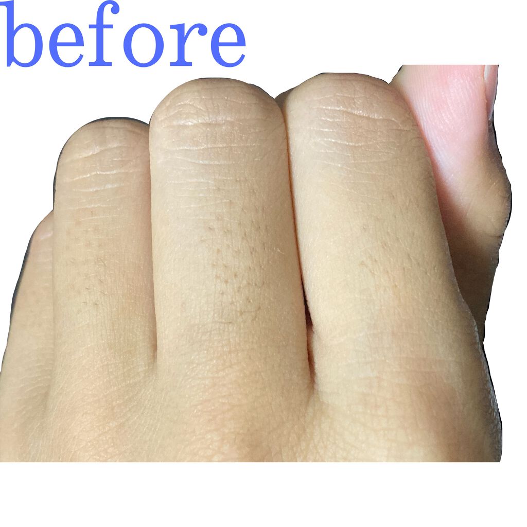 ニベアクリーム ニベアを使った口コミ あれ 指の毛穴 どこ行った はい こん By りんにゃこ 普通肌 10代後半 Lips