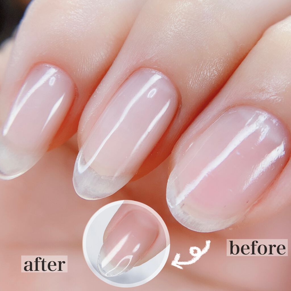 ローションティシュー エリエールを使った口コミ ジェル長さ出しティッシュでやってみた By 蒙古襞298 のa子さん 混合肌 30代前半 Lips