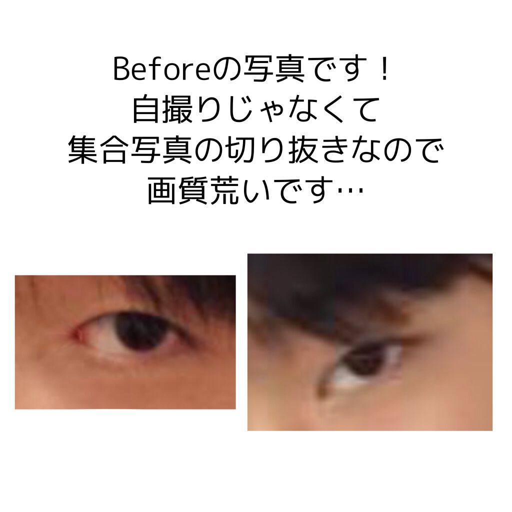 ナチュリエ ハトムギ保湿ジェル ナチュリエ スキンコンディショニングジェル ナチュリエの効果に関する口コミ 即効 涙袋が爆誕する筋トレとマッサージ By ﾘﾝｶ 乾燥肌 10代後半 Lips