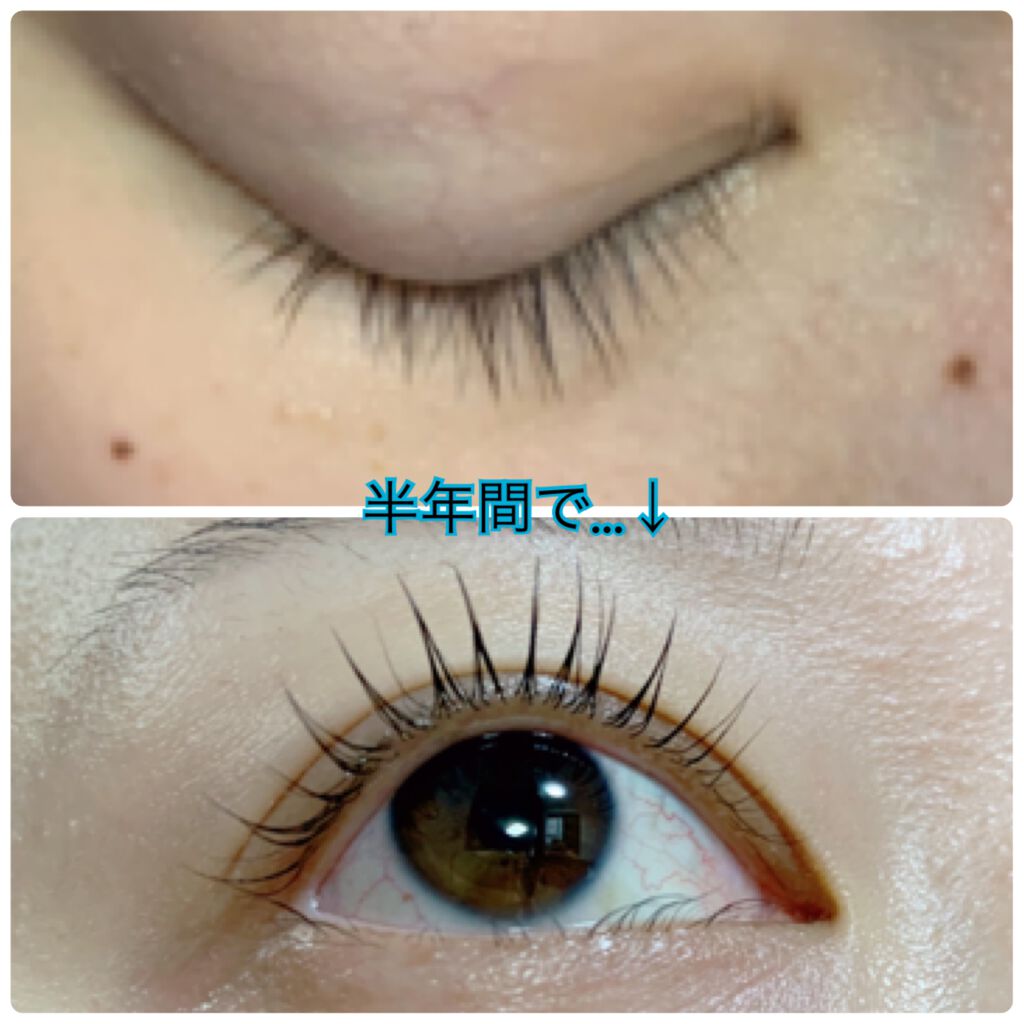 Emaked 水橋保寿堂製薬を使った口コミ 産後のスカスカまつ毛から褒められまつ毛にな By じゅんのママ 乾燥肌 代後半 Lips