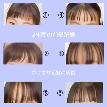 あんず油 柳屋あんず油の使い方を徹底解説 ボサボサ前髪の成長記録 こんにちは Hi By Hirari 新しいアカウントに変えました 週3 5投稿 普通肌 10代前半 Lips