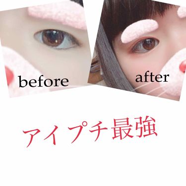 アイトーク アイトークの口コミ こんにちは 今回はアイプチを紹介します By み 普通肌 10代後半 Lips