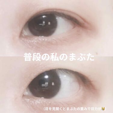 アイビューティーフィクサーwp アストレア ヴィルゴを使った口コミ まぶたビロビロの民でも 綺麗な二重になりた By ねこみかん 混合肌 代前半 Lips