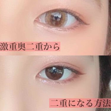 のびるアイテープ セリアの使い方を徹底解説 超優秀 100均で買えるおすすめ二重まぶた用アイテム もんです 今回は私が By ぴまる 混合肌 代前半 Lips