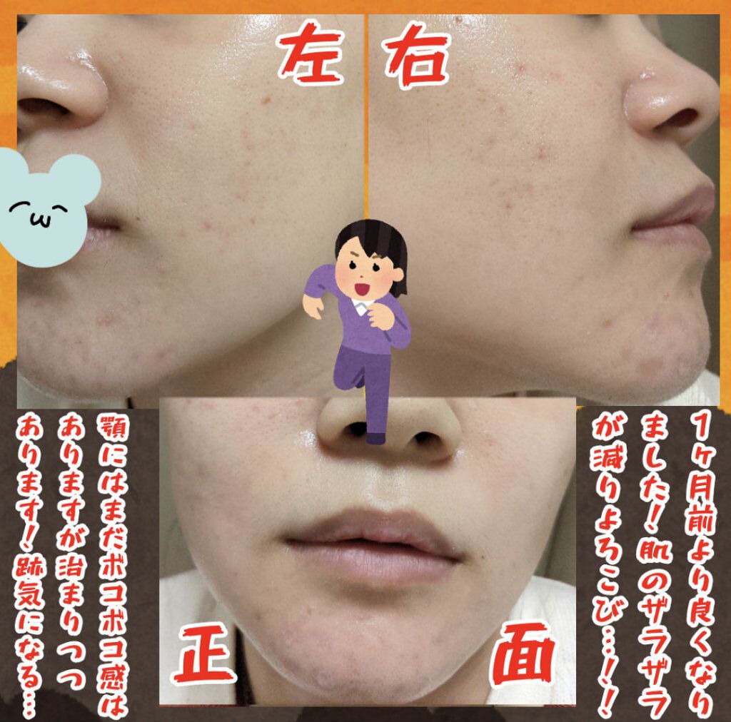 ソープd Novを使った口コミ こんにちは 田海ですᕙ ᕗ 素材 By 田海 混合肌 代前半 Lips