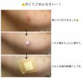 1000円以下 ペアアクネクリームw 医薬品 ペアのリアルな口コミ レビュー Lips