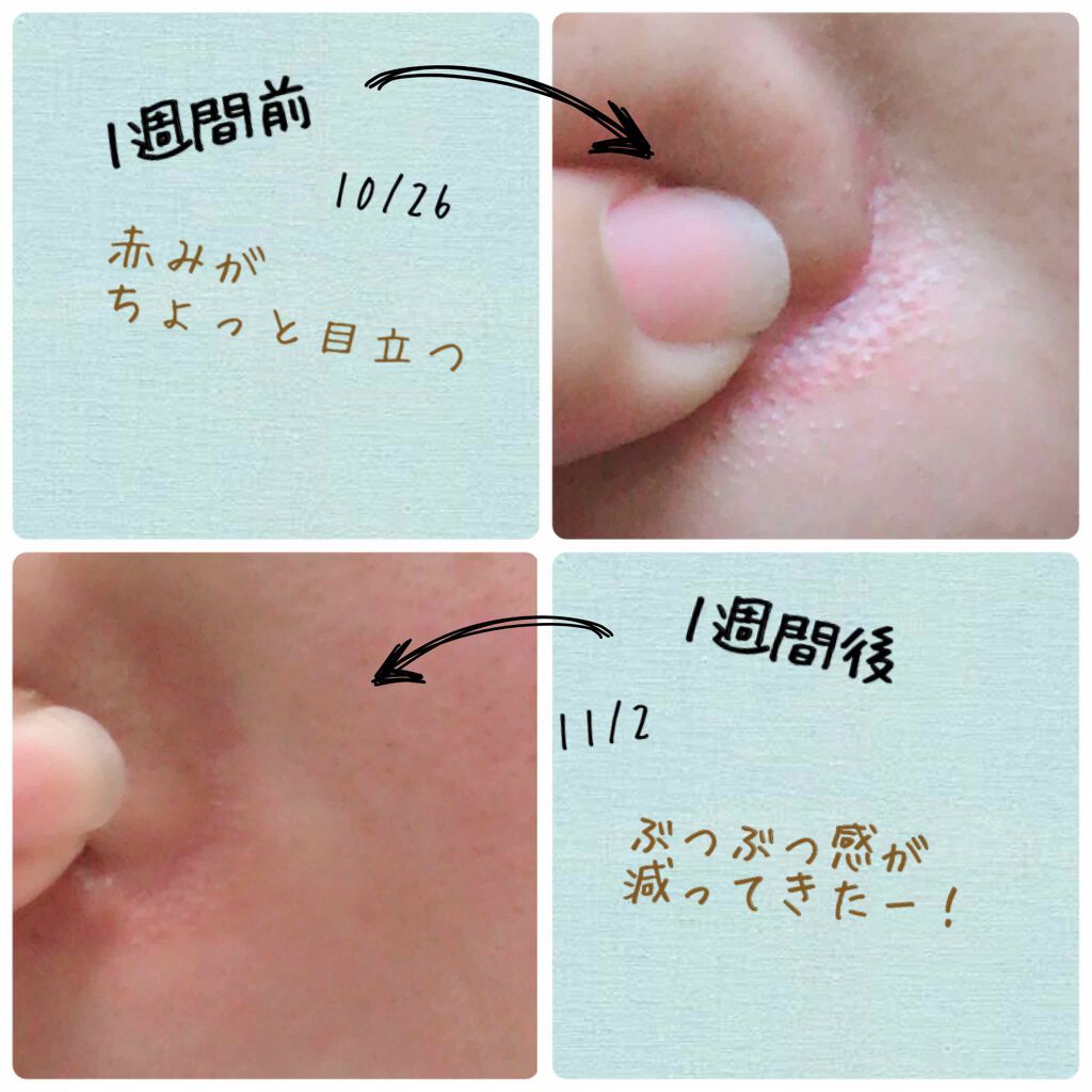 ファストシリーズ ミラクルクレンジング Kooを使った口コミ Kooで1週間夜だけ美容断食生活してました By すもも フォロバ100 混合肌 Lips