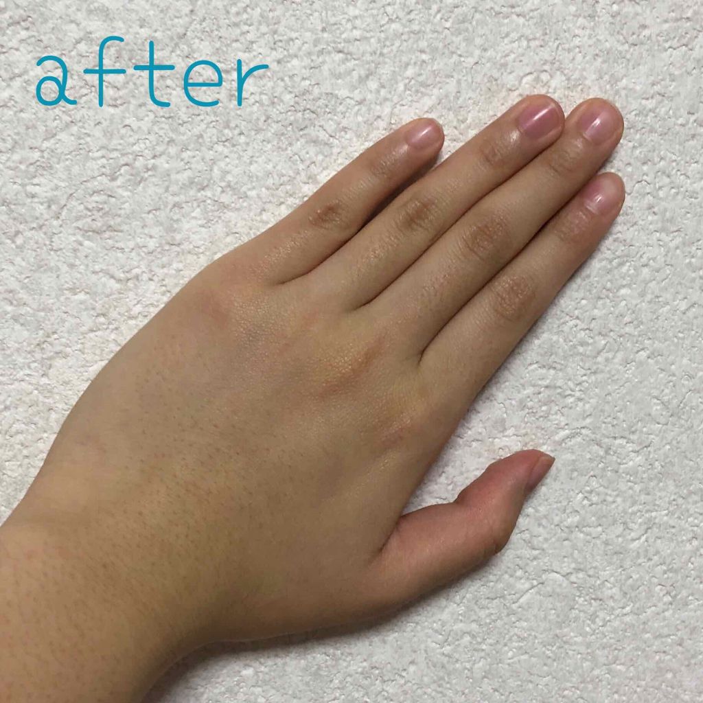 エバレッシュホワイトex 医薬品 エバレッシュの口コミ こんにちは お久しぶりです Amyと言いま By Amy 敏感肌 代前半 Lips