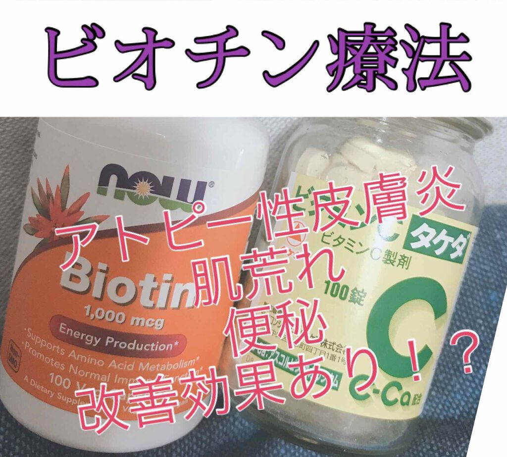 ビオチン Now Foodsを使った口コミ ビオチン療法って知ってますかー ビオチン By 麦茶豆 フォロバ100 敏感肌 30代前半 Lips