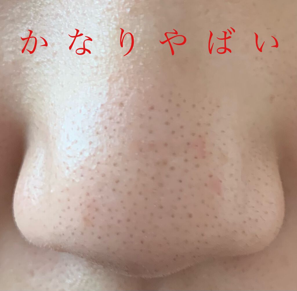 デュオ ザ クレンジングバーム ブラック Duoの口コミ あのduo黒ほんとに効果あるのか 検証 By サバの味噌煮 混合肌 10代後半 Lips