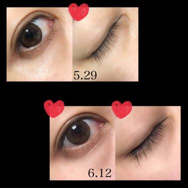 アイラッシュセラム Phoebe Beauty Upの口コミ まつ育記録 21 6 12 使い By Mimi 敏感肌 代後半 Lips