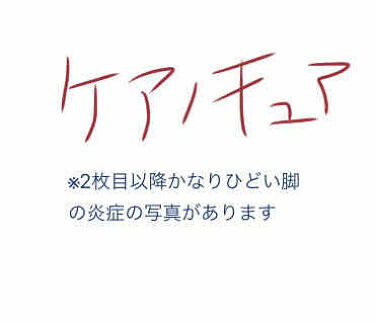 ケアノキュア 医薬品 小林製薬のリアルな口コミ レビュー Lips