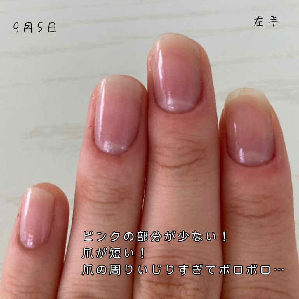 Ac キューティクルオイル Ac Makeupを使った口コミ 何事も三日坊主になりがちの私 爪育始めます By うさお 10代後半 Lips