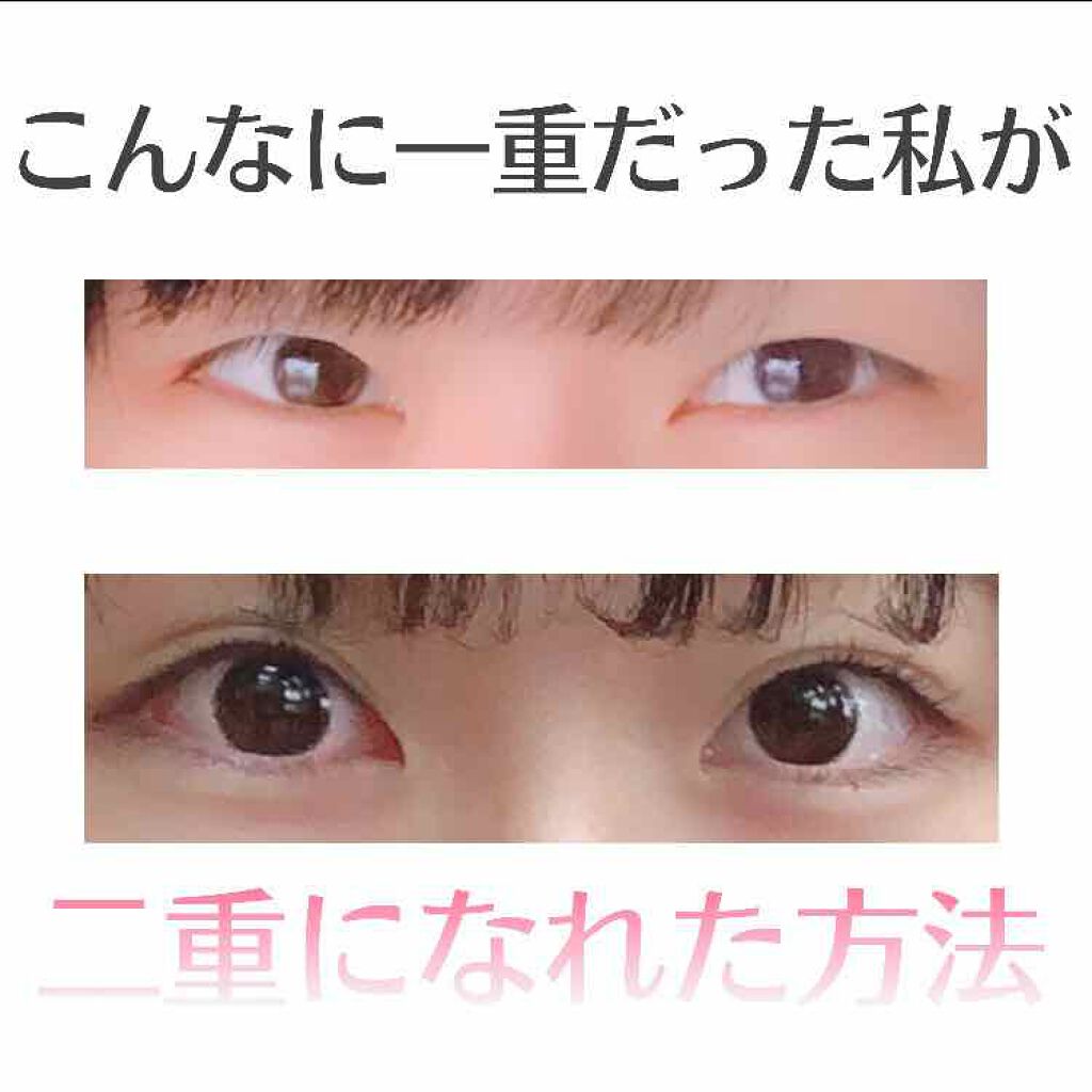 二重になる方法 ふたえテープ 目立たず肌になじむ絆創膏タイプ Daisoの使い方や二重メイク みなさんこんにちは ｿ By ｿﾗ 敏感肌 10代後半 Lips