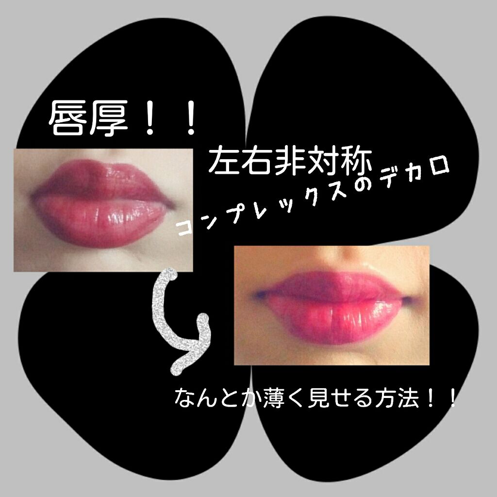 コンシーラーa Mediaの口コミ 突然ながらコンプレックスがあります それは By 来夢 普通肌 Lips