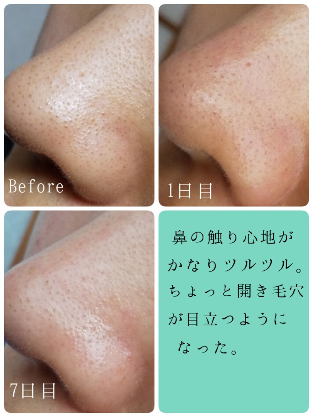 Pore Control Blackhead Off Sheet ビューティシート Ciracleの使い方を徹底解説 韓国のブラックヘッドオフシートの検証 画像 By いももち 混合肌 代前半 Lips