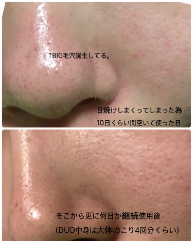 21正規激安 Duo クレンジングバーム 黒 ブラックリペア デュオ 黒ずみ毛穴 New限定品 Kotsadoroiladas Gr