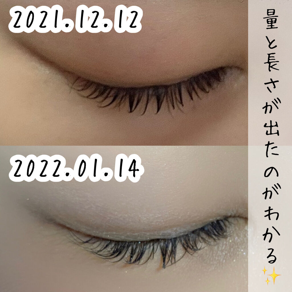 エグータム アルマダスタイルの口コミ 1か月でここまで伸びた 増えたアルマダス By Misora Scosme 毎日投稿 混合肌 代前半 Lips