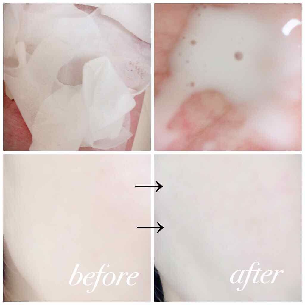 0 2エアフィットマスク Etudeの効果に関する口コミ ニキビケアにおすすめのシートマスク パック あの噂の肌再生シカ By Chanel Chan 延命治療中 混合肌 Lips