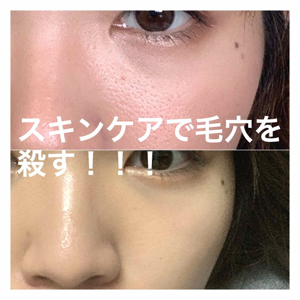 エリクシール ルフレ バランシング おやすみマスク エリクシールの効果に関する口コミ 乾燥肌におすすめのフェイスクリーム サムネからグロ画像です By トリキモ 混合肌 代前半 Lips