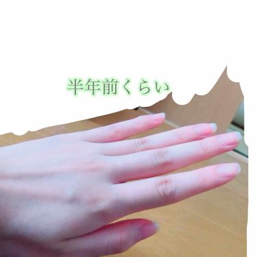 ディープセラム Dr Nailを使った口コミ 育爪日記part1爪って 見られてますよね By にゃん 敏感肌 10代後半 Lips