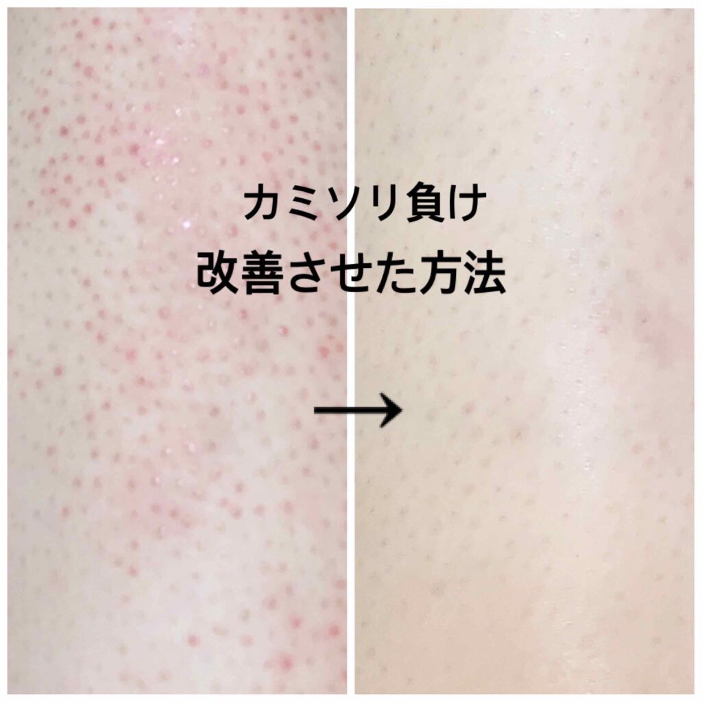 ノルウェー フォーミュラ インテンスリペア ボディ エマルジョン Neutrogenaの口コミ 前回の投稿でカミソリ負けで悩んでると投稿し By Mocaフォロバ100 敏感肌 10代後半 Lips