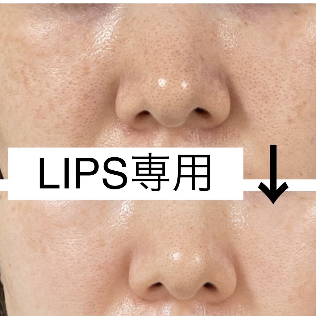 リッチホワイトエッセンス ドクターリセラを使った口コミ クスミとシミやそばかす 毛穴の開きに悩んで By 子育てママ 混合肌 30代前半 Lips
