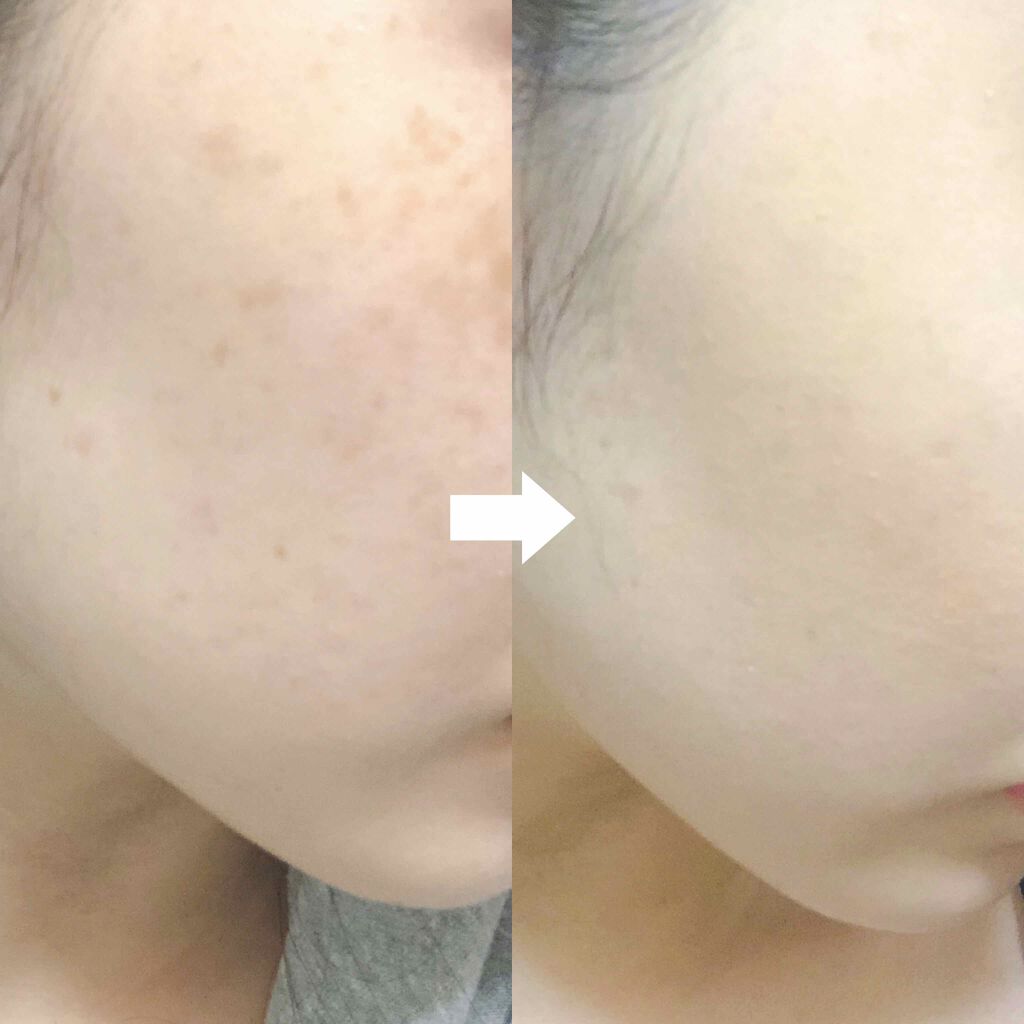 カバーパーフェクト チップ コンシーラー The Saemの口コミ 乾燥肌におすすめのコンシーラー 出会ってよかった By ぬこ 乾燥肌 代前半 Lips