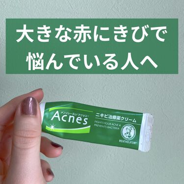 ニキビ治療薬 医薬品 メンソレータム アクネスの使い方を徹底解説 メンソレータムアクネスのニキビ治療薬をレビ By きりん フォロバ 敏感肌 代前半 Lips