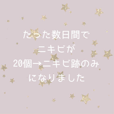 ベピオゲル 医薬品 の口コミ ニキビもそろそろおれらの肌から卒業した方が By まろ 混合肌 10代後半 Lips