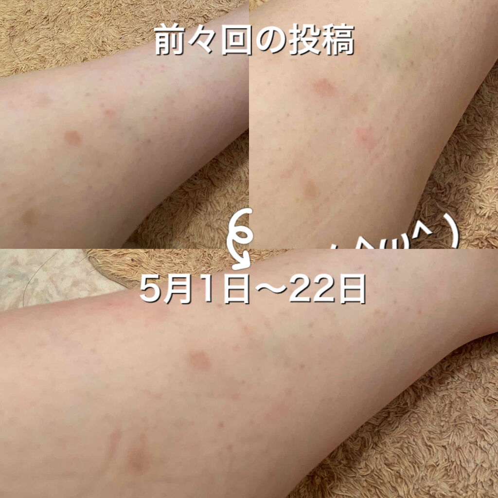 薬用しみ対策 美白化粧水 メンソレータム メラノccを使った口コミ こんにちは 暑くなったり寒くなったりで皆さ By Amin 敏感肌 30代前半 Lips