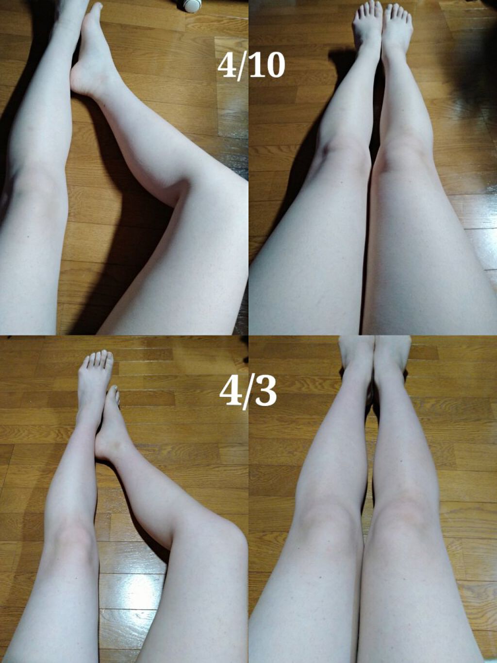 寝ながらメディキュット フルレッグ メディキュットの口コミ 梨 です 1週間前に投稿した 1週間ダイエ By 梨 敏感肌 10代後半 Lips