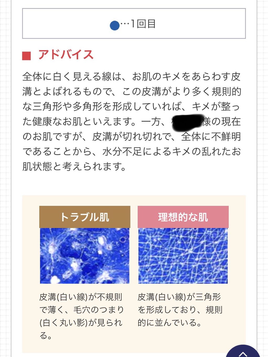 ライスフォース30日セット ライスフォースの口コミ ライスフォース30日セットを使い切って感想 By アラサー奮闘記 混合肌 30代前半 Lips