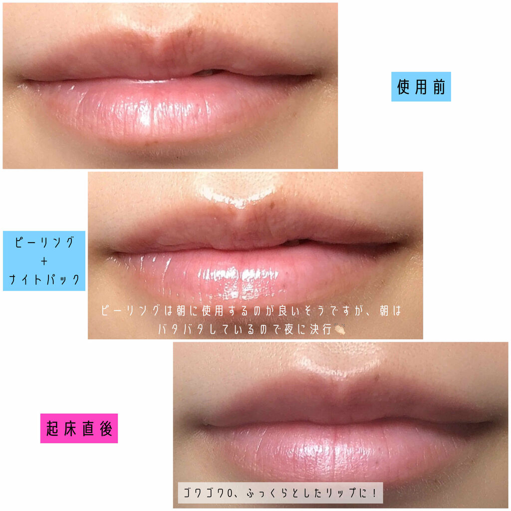 唇のナイトパック リップルンを使った口コミ こんにちは 本日も投稿をご覧いただきあり By tamaki 混合肌 代前半 Lips 唇のナイトパック リップルンを使った口コミ こんにちは 本日も投稿をご覧いただきあり By tamaki 混合肌 代前半 Lips