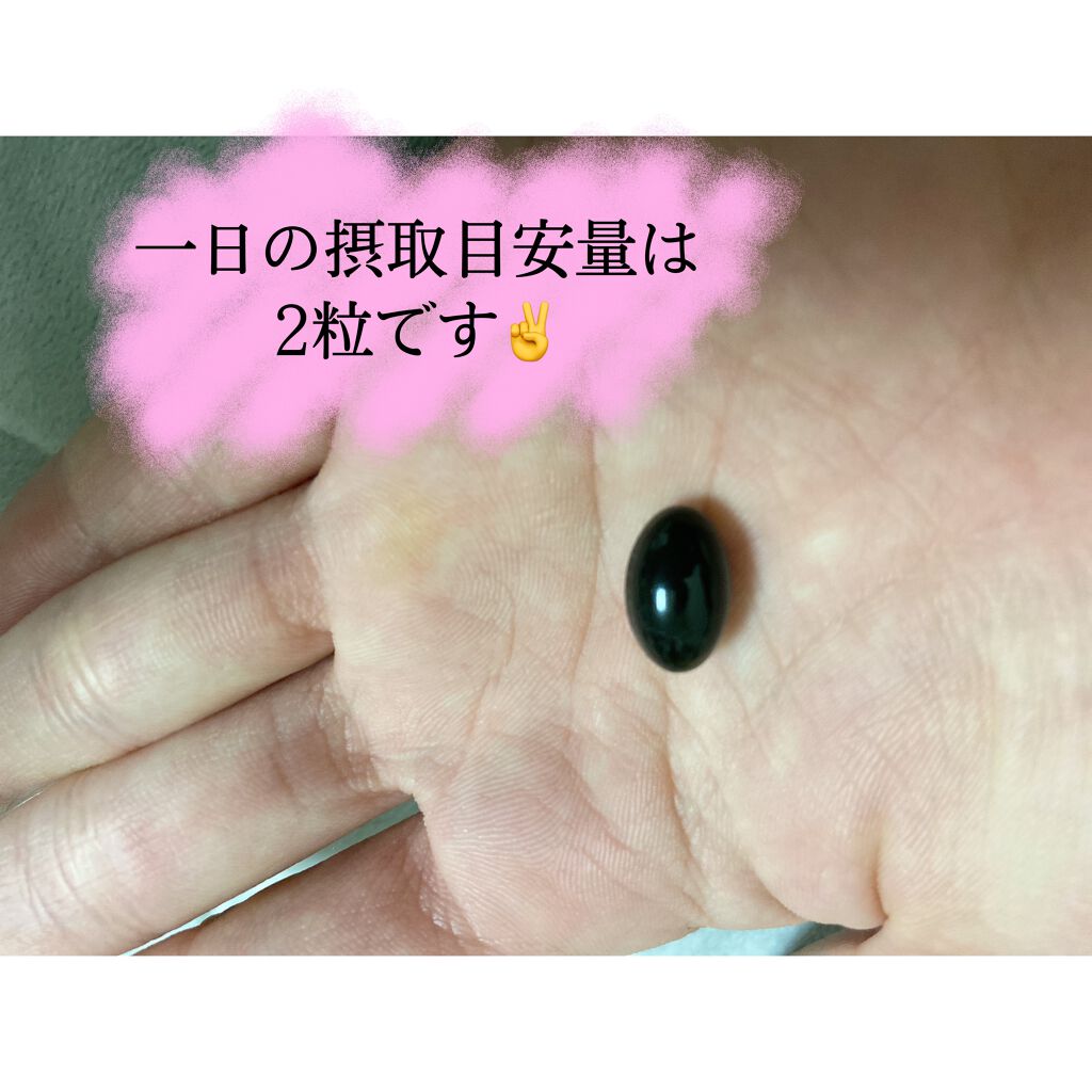 プレミアム生酵素カプセル ボーテサンテラボラトリーズの口コミ まず 遅くなりましたがあけましておめでとう By みや 乾燥肌 代前半 Lips