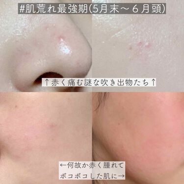 スキンケア方法 マデカソ Cicaクリーム A Pieuの使い方 効果 By Koyagi 乾燥肌 代後半 Lips