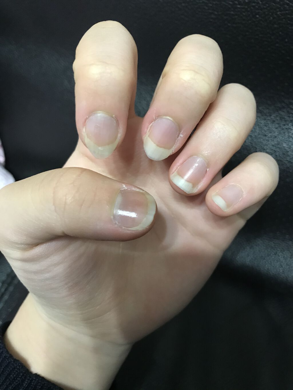 クイックケアコート Ettusaisを使った口コミ 治したい人必見 絶対爪噛みを治す方法 By ｍｉｋｕｒｕ 普通肌 10代後半 Lips