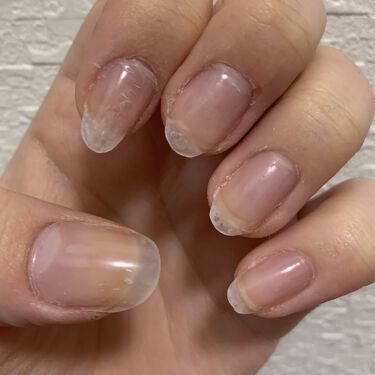 バーチャルジェルファーストキット ビューティーワールドの口コミ 1日で爪が伸びる 万年深爪がバーチャルジ By いつか 正直レビュー 混合肌 代後半 Lips