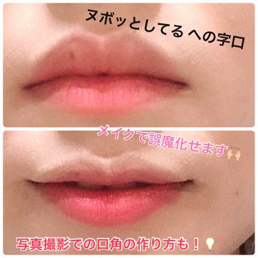 薬用リップクリーム Dhcを使った口コミ その への字口と大きな上唇がコンプレックス By Sarina 乾燥肌 30代前半 Lips