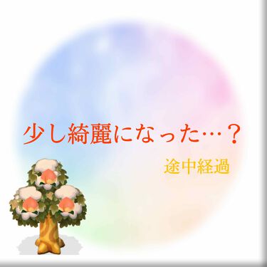 薬用クリーム ニキビケアのリアルな口コミ レビュー Lips