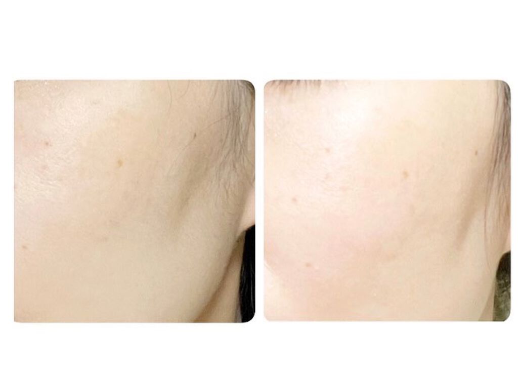 キュエリスト フェイスリフト エマルジョン ドゥーシェーンの効果に関する口コミ キュエリスト フェイス リフト エマルジョ By ひろぷー 乾燥肌 40代後半 Lips