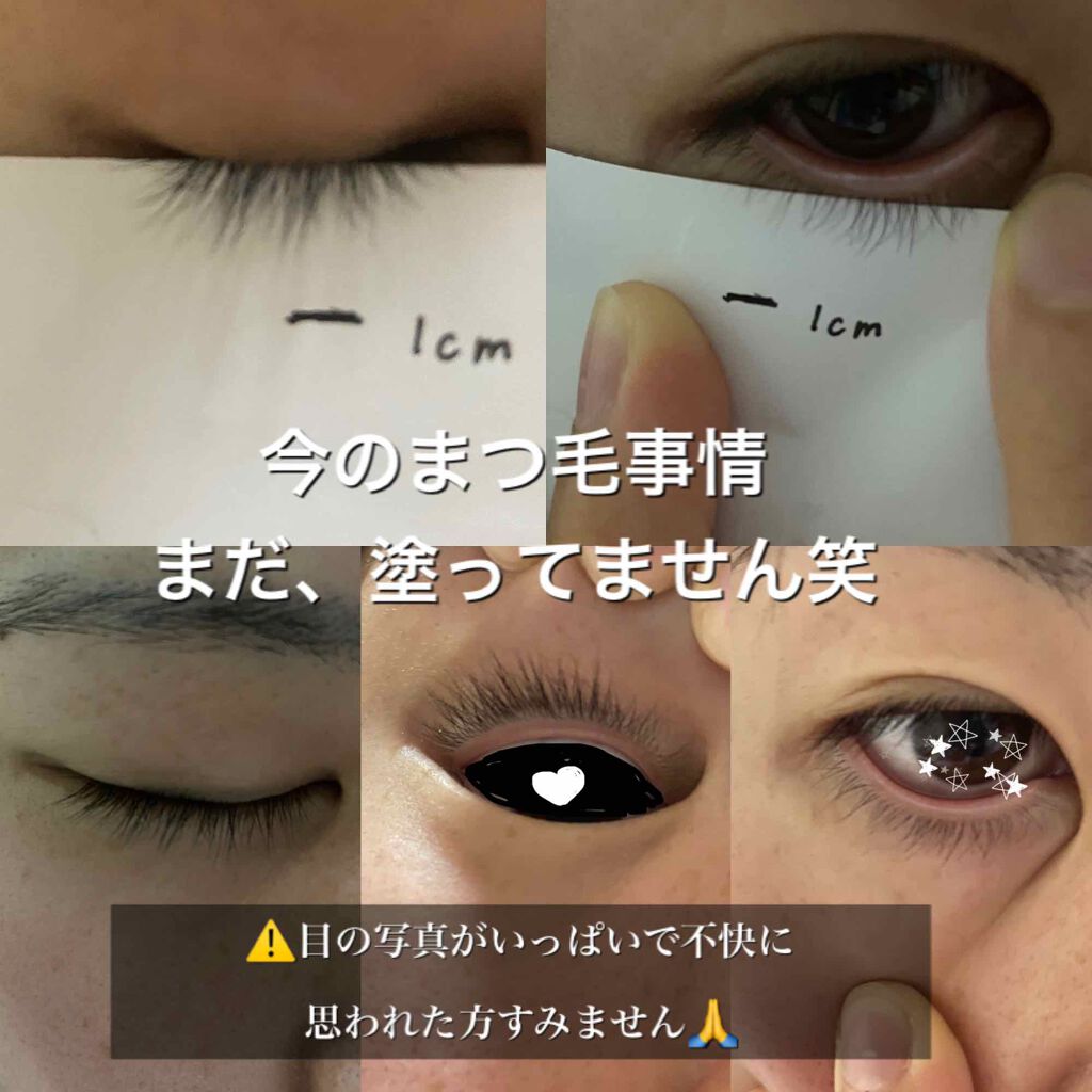 限定まつげ美容液 Emaked 水橋保寿堂製薬の効果に関する口コミ ついについに 本気でマツ育始めました By ちー 敏感肌 代前半 Lips